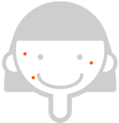 여드름, 여드름흉터