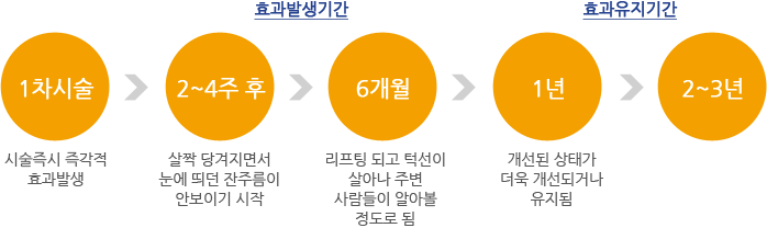 TR라인 시술순서