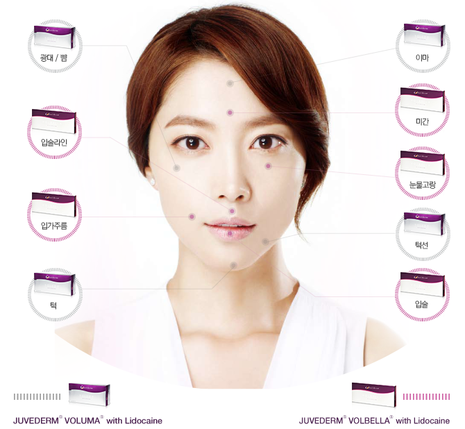 쥬비덤필러 시술부위
