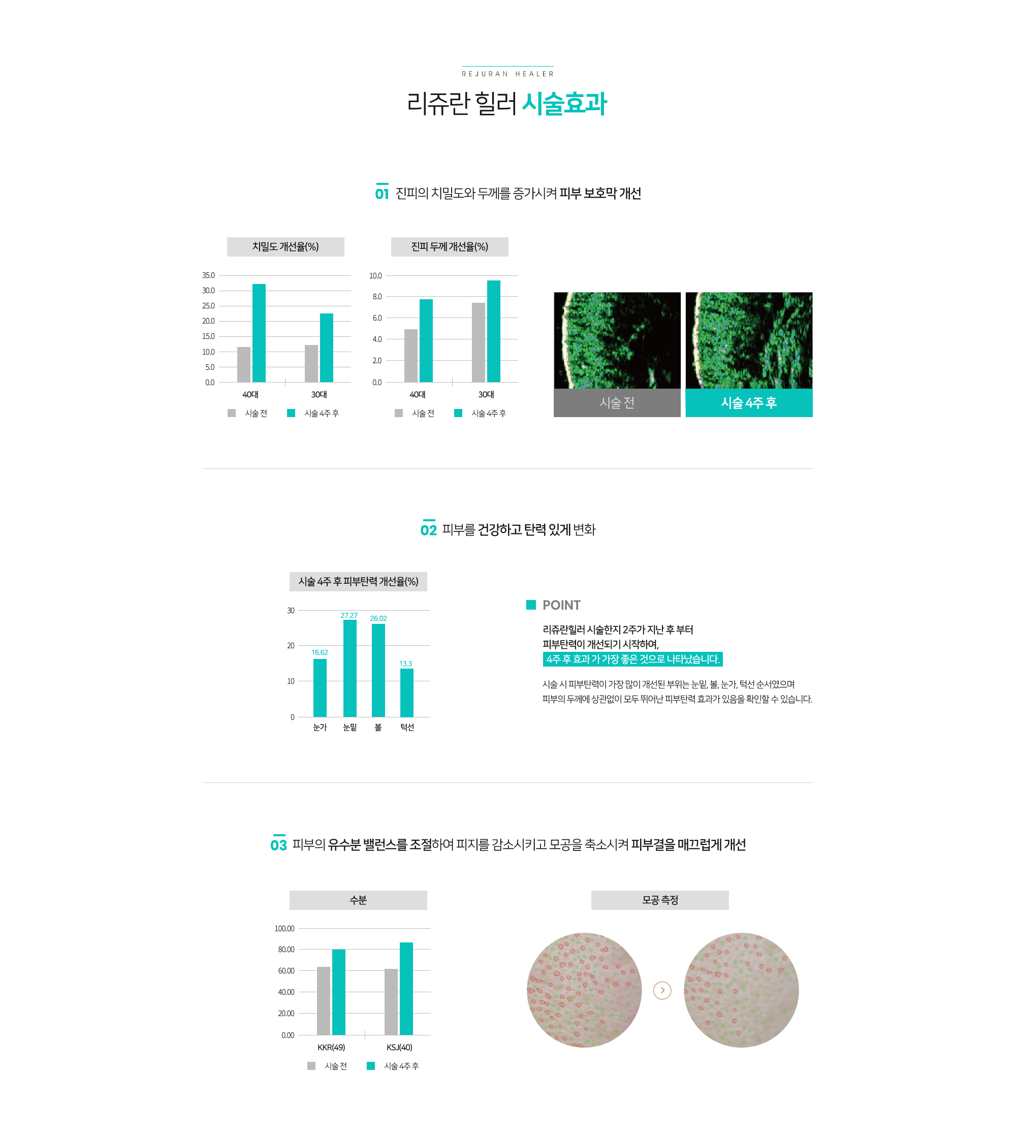 리쥬란힐러